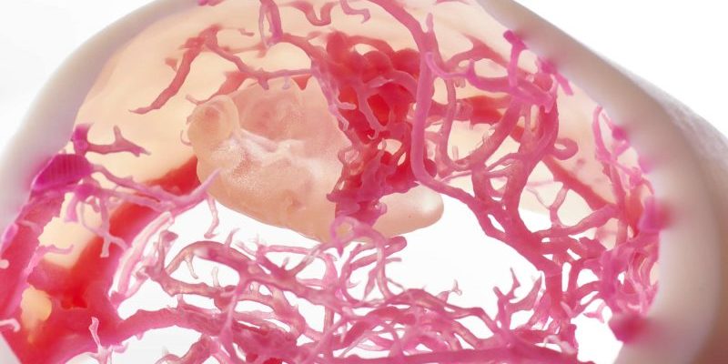 3D printed anatomical model Medical Applications